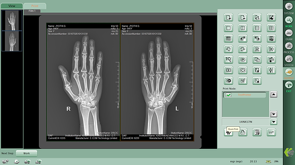 Wireless Portable Xray Detector